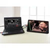 מסך קיבולי LCD 15.6" IPS 1920x1080, מסגרת, זכוכית מגן, רמקול, ממשק HDMI, מגע USB
